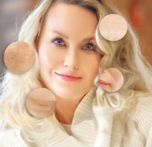 Benefits of Nativepath Skin Renewal